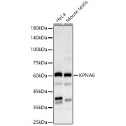 Western blot analysis of various lysates, using KPNA6 Antibody at 1/2000 dilution. Secondary antibody: HRP-conjugated Goat anti-Rabbit IgG (H+L) at 1/10000 dilution. Lysates/proteins: 25 µg per lane. Blocking buffer: 3% nonfat dry milk in TBST. Exposure time: 60s.