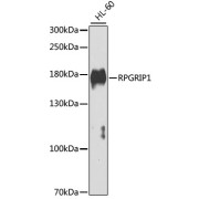Western blot analysis of lysates from HL-60 cells, using RPGRIP1 Antibody at 1/1000 dilution. Secondary antibody: HRP-conjugated Goat anti-Rabbit IgG (H+L) at 1/10000 dilution. Lysates/proteins: 25 µg per lane. Blocking buffer: 3% nonfat dry milk in TBST. Exposure time: 30s.
