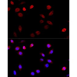 Tether Containing UBX Domain for GLUT4 / TUG (ASPSCR1) Antibody