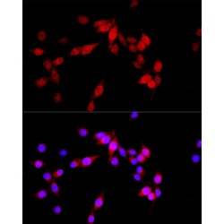 Tether Containing UBX Domain for GLUT4 / TUG (ASPSCR1) Antibody
