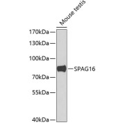 Western blot analysis of lysates from mouse testis, using SPAG16 Antibody at 1/1000 dilution. Secondary antibody: HRP-conjugated Goat anti-Rabbit IgG (H+L) at 1/10000 dilution. Lysates/proteins: 25 µg per lane. Blocking buffer: 3% nonfat dry milk in TBST. Exposure time: 90s.