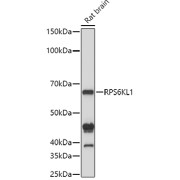 Western blot analysis of lysates from Rat brain , using RPS6KL1 Antibody at 1/1000 dilution. Secondary antibody: HRP-conjugated Goat anti-Rabbit IgG (H+L) at 1/10000 dilution. Lysates/proteins: 25 µg per lane. Blocking buffer: 3% nonfat dry milk in TBST. Exposure time: 10s.