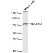 Western blot analysis of lysates from mouse testis, using HDGFRP2 Antibody at 1/1000 dilution. Secondary antibody: HRP-conjugated Goat anti-Rabbit IgG (H+L) at 1/10000 dilution. Lysates/proteins: 25 µg per lane. Blocking buffer: 3% nonfat dry milk in TBST. Exposure time: 30s.