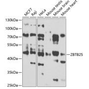 Western blot analysis of various lysates using ZBTB25 Antibody at 1/1000 dilution. Secondary antibody: HRP-conjugated Goat anti-Rabbit IgG (H+L) at 1/10000 dilution. Lysates/proteins: 25 µg per lane. Blocking buffer: 3% nonfat dry milk in TBST. Exposure time: 90s.