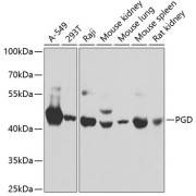 Western blot analysis of various lysates using PGD Antibody at 1/1000 dilution. Secondary antibody: HRP-conjugated Goat anti-Rabbit IgG (H+L) at 1/10000 dilution. Lysates/proteins: 25 µg per lane. Blocking buffer: 3% nonfat dry milk in TBST.