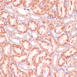 Phosphogluconate Dehydrogenase (PGD) Antibody