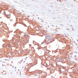 Phosphogluconate Dehydrogenase (PGD) Antibody