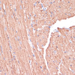 Phosphogluconate Dehydrogenase (PGD) Antibody