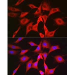 Phosphogluconate Dehydrogenase (PGD) Antibody