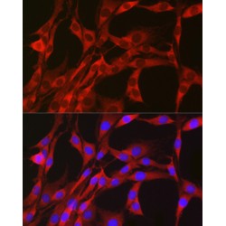 Phosphogluconate Dehydrogenase (PGD) Antibody