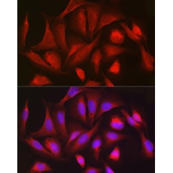 Phosphogluconate Dehydrogenase (PGD) Antibody