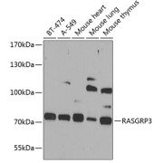 Western blot analysis of various lysates using RASGRP3 Antibody at 1/1000 dilution. Secondary antibody: HRP-conjugated Goat anti-Rabbit IgG (H+L) at 1/10000 dilution. Lysates/proteins: 25 µg per lane. Blocking buffer: 3% nonfat dry milk in TBST. Exposure time: 90s.