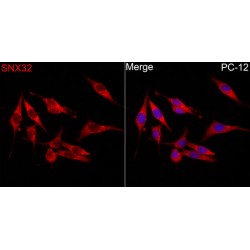 Sorting Nexin 32 (SNX32) Antibody