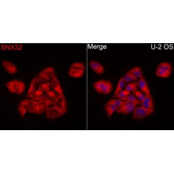 Sorting Nexin 32 (SNX32) Antibody