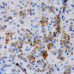 Cytochrome P450 24A1 (CYP24A1) Antibody