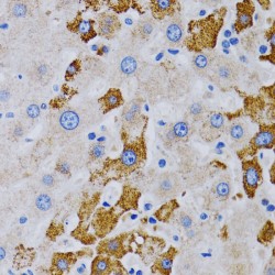 Cytochrome P450 24A1 (CYP24A1) Antibody