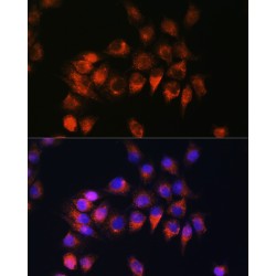Bradykinin Receptor B2 (BDKRB2) Antibody