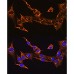 Bradykinin Receptor B2 (BDKRB2) Antibody