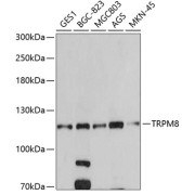 Western blot analysis of various lysates using TRPM8 Antibody at 1/500 dilution. Secondary antibody: HRP-conjugated Goat anti-Rabbit IgG (H+L) at 1/10000 dilution. Lysates/proteins: 25 µg per lane. Blocking buffer: 3% nonfat dry milk in TBST. Exposure time: 60s.