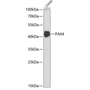 abx006777