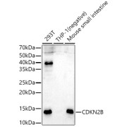 Western blot analysis of various lysates using CDKN2B Antibody at 1/800 dilution. Secondary antibody: HRP-conjugated Goat anti-Rabbit IgG (H+L) at 1/10000 dilution. Lysates/proteins: 25 µg per lane. Blocking buffer: 3% nonfat dry milk in TBST. Exposure time: 90s.