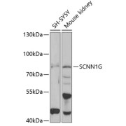 Western blot analysis of various lysates using SCNN1G Antibody at 1/1000 dilution. Secondary antibody: HRP-conjugated Goat anti-Rabbit IgG (H+L) at 1/10000 dilution. Lysates/proteins: 25 µg per lane. Blocking buffer: 3% nonfat dry milk in TBST. Exposure time: 60s.