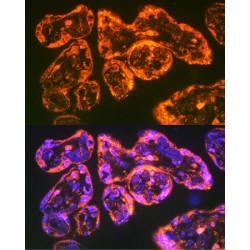 Integrin Alpha 5 (ITGA5) Antibody