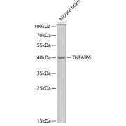 Western blot analysis of lysates from mouse brain, using TNFAIP6 Antibody at 1/1000 dilution. Secondary antibody: HRP-conjugated Goat anti-Rabbit IgG (H+L) at 1/10000 dilution. Lysates/proteins: 25 µg per lane. Blocking buffer: 3% nonfat dry milk in TBST. Exposure time: 90s.