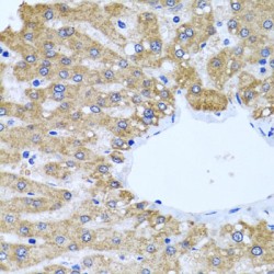Cerebral Cavernous Malformations 2 Protein (CCM2) Antibody