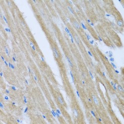 Cerebral Cavernous Malformations 2 Protein (CCM2) Antibody
