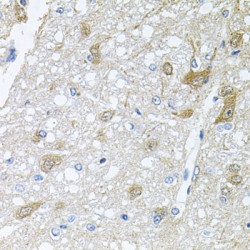 Receptor Associated Protein of The Synapse (RAPSN) Antibody