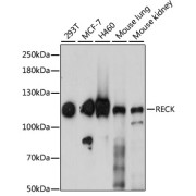 Western blot analysis of various lysates using RECK Antibody at 1/1000 dilution. Secondary antibody: HRP-conjugated Goat anti-Rabbit IgG (H+L) at 1/10000 dilution. Lysates/proteins: 25 µg per lane. Blocking buffer: 3% nonfat dry milk in TBST. Exposure time: 60s.