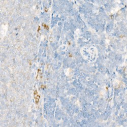 Polyunsaturated Fatty Acid Lipoxygenase ALOX15 (ALOX15) Antibody