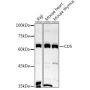 Western blot analysis of various lysates using CD5 Antibody at 1/1000 dilution. Secondary antibody: HRP-conjugated Goat anti-Rabbit IgG (H+L) at 1/10000 dilution. Lysates/proteins: 25 µg per lane. Blocking buffer: 3% nonfat dry milk in TBST. Exposure time: 90s.