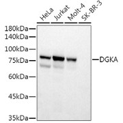 Western blot analysis of various lysates using DGKA Antibody at 1/500 dilution. Secondary antibody: HRP-conjugated Goat anti-Rabbit IgG (H+L) at 1/10000 dilution. Lysates/proteins: 25 µg per lane. Blocking buffer: 3% nonfat dry milk in TBST. Exposure time: 3s.