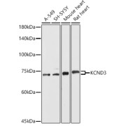 Western blot analysis of various lysates using KCND3 Antibody at 1/500 dilution. Secondary antibody: HRP-conjugated Goat anti-Rabbit IgG (H+L) at 1/10000 dilution. Lysates/proteins: 25 µg per lane. Blocking buffer: 3% nonfat dry milk in TBST. Exposure time: 90s.