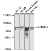 Western blot analysis of various lysates using HNRNPM Antibody at 1/1000 dilution. Secondary antibody: HRP-conjugated Goat anti-Rabbit IgG (H+L) at 1/10000 dilution. Lysates/proteins: 25 µg per lane. Blocking buffer: 3% nonfat dry milk in TBST. Exposure time: 60s.