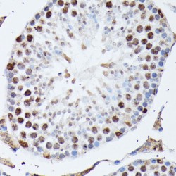 Heterogeneous Nuclear Ribonucleoprotein M (HNRNPM) Antibody