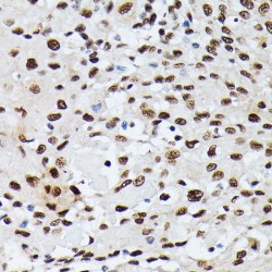 Heterogeneous Nuclear Ribonucleoprotein M (HNRNPM) Antibody