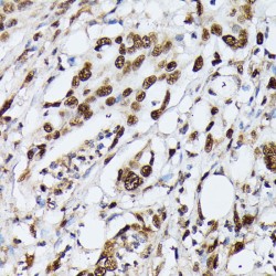 Heterogeneous Nuclear Ribonucleoprotein M (HNRNPM) Antibody