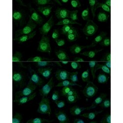 Heterogeneous Nuclear Ribonucleoprotein M (HNRNPM) Antibody