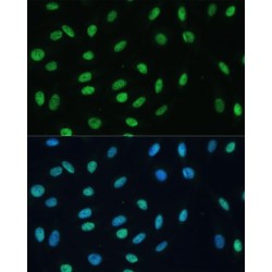 Heterogeneous Nuclear Ribonucleoprotein M (HNRNPM) Antibody