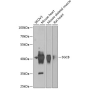 Western blot analysis of various lysates using SGCB Antibody at 1/1000 dilution. Secondary antibody: HRP-conjugated Goat anti-Rabbit IgG (H+L) at 1/10000 dilution. Lysates/proteins: 25 µg per lane. Blocking buffer: 3% nonfat dry milk in TBST. Exposure time: 90s.