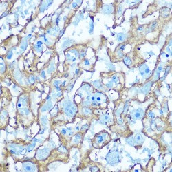 Solute Carrier Family 2, Facilitated Glucose Transporter Member 1 (SLC2A1) Antibody