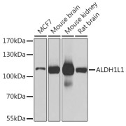Western blot analysis of various lysates using ALDH1L1 Antibody at 1/1000 dilution. Secondary antibody: HRP-conjugated Goat anti-Rabbit IgG (H+L) at 1/10000 dilution. Lysates/proteins: 25 µg per lane. Blocking buffer: 3% nonfat dry milk in TBST. Exposure time: 1s.