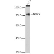 Western blot analysis of lysates from PC-3 cells, using NOX5 Antibody at 1/1000 dilution. Secondary antibody: HRP-conjugated Goat anti-Rabbit IgG (H+L) at 1/10000 dilution. Lysates/proteins: 25 µg per lane. Blocking buffer: 3% nonfat dry milk in TBST. Exposure time: 180s.