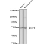 Western blot analysis of various lysates using LACTB Antibody at 1/1000 dilution. Secondary antibody: HRP-conjugated Goat anti-Rabbit IgG (H+L) at 1/10000 dilution. Lysates/proteins: 25 µg per lane. Blocking buffer: 3% nonfat dry milk in TBST. Exposure time: 1s.