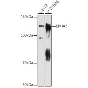Western blot analysis of various lysates using EPHA2 Antibody at 1/1000 dilution. Secondary antibody: HRP-conjugated Goat anti-Rabbit IgG (H+L) at 1/10000 dilution. Lysates/proteins: 25 µg per lane. Blocking buffer: 3% nonfat dry milk in TBST. Exposure time: 180s.