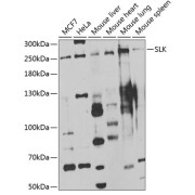 Western blot analysis of various lysates using SLK Antibody at 1/1000 dilution. Secondary antibody: HRP-conjugated Goat anti-Rabbit IgG (H+L) at 1/10000 dilution. Lysates/proteins: 25 µg per lane. Blocking buffer: 3% nonfat dry milk in TBST. Exposure time: 90s.
