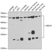 Western blot analysis of various lysates using UBE2H Antibody at 1/1000 dilution. Secondary antibody: HRP-conjugated Goat anti-Rabbit IgG (H+L) at 1/10000 dilution. Lysates/proteins: 25 µg per lane. Blocking buffer: 3% nonfat dry milk in TBST. Exposure time: 90s.